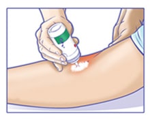 Comment arrêter un saignement sous anticoagulant? | Coalgan Gamme