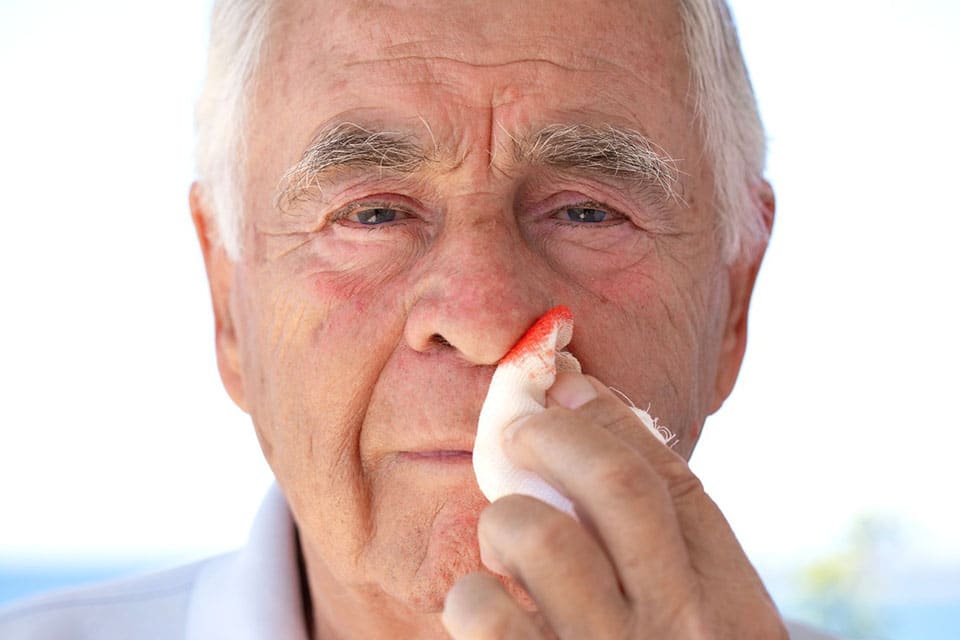 Hypertension et saignement de nez : arrêter un saignement rapidement